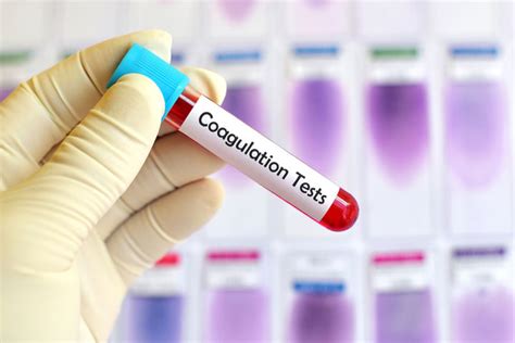 blood clotting test results